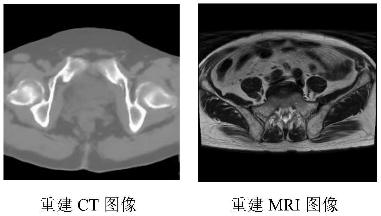 CT图像与MRI图像的跨模态转换方法和装置_专利查询 - 企查查